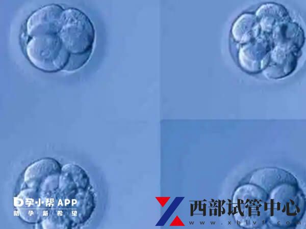 試管嬰兒成功率由什么決定